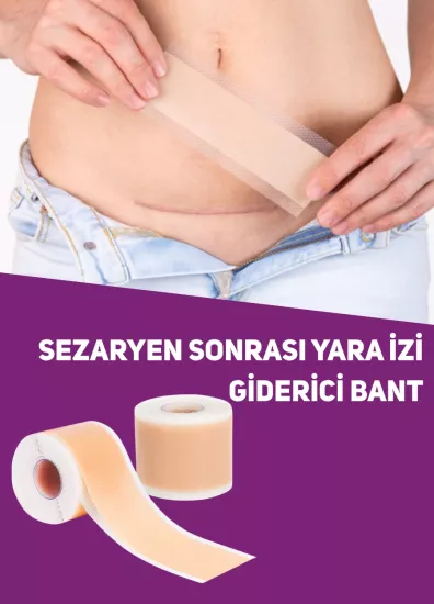 Sezaryen Sonrası Yara İzi Giderici Bant 